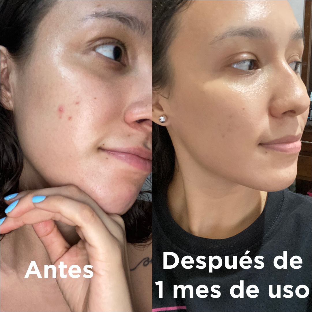 Serum Hidratante en uso